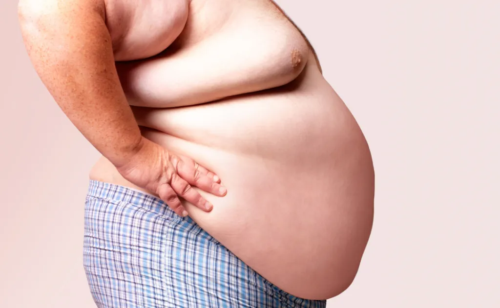 obesidad y sus efectos en la salud